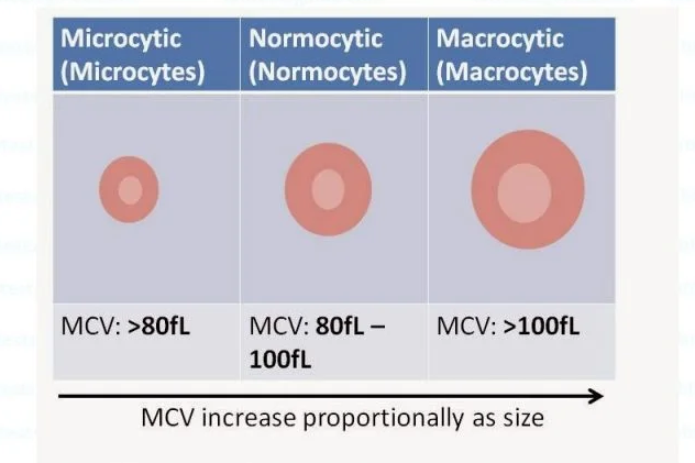 تحلیل آزمایش پزشکی، حجم متوسط گلبول قرمز یا MCV