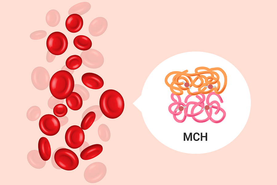 تحلیل آزمایش پزشکی، مقدار متوسط هموگلوبین در هر گلبول قرمز یا MCH