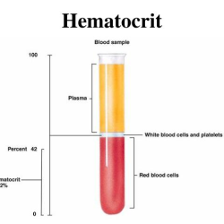 تحلیل آزمایش پزشکی، هماتوکریت یا HCT