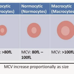 تحلیل آزمایش پزشکی، حجم متوسط گلبول قرمز یا MCV