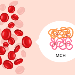 تحلیل آزمایش پزشکی، مقدار متوسط هموگلوبین در هر گلبول قرمز یا MCH